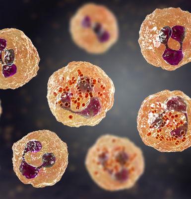 Hematologic Malignancies